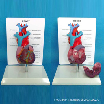 Modèle médical de démonstration anatomique cardiaque avec description (R120107)